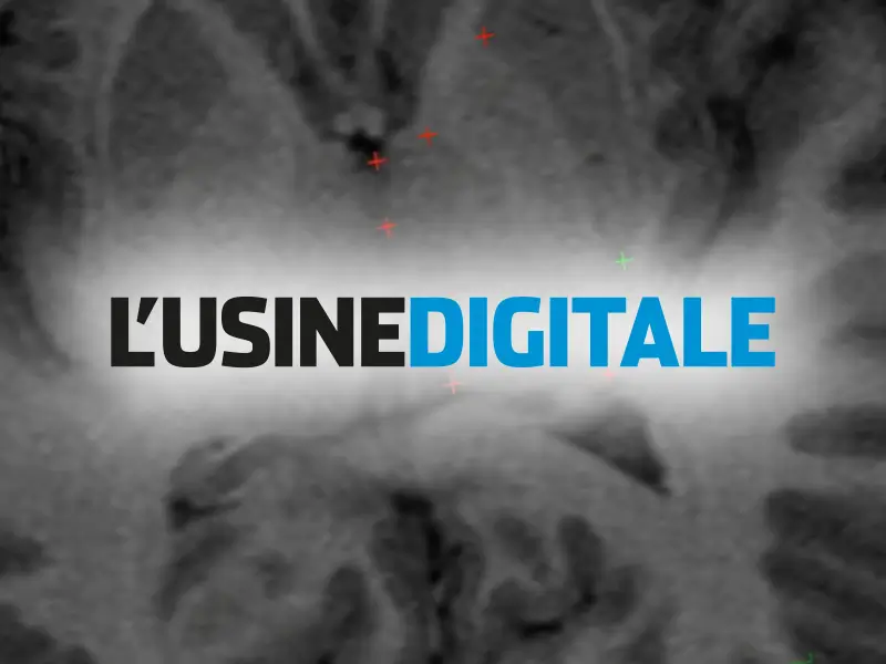 L’Usine Digitale Highlights RebrAIn’s €3.7 Million Funding for Supervised AI-Driven Neurosurgery